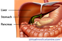 Pancreatic cancer picture