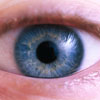 Ischaemic maculopathy picture