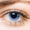 Non-proliferative diabetic retinopathy picture